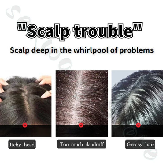 Vichy anti-dandruff treatment shampoo with selenium disulfide